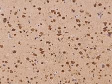 NACAD Antibody - Immunochemical staining of human NACAD in human brain with rabbit polyclonal antibody at 1:100 dilution, formalin-fixed paraffin embedded sections.