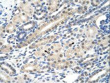 NACC1 / NAC1 Antibody - NACC1 / NAC-1 antibody ARP39772_T100-NP_443108-BTBD14B (BTB (POZ) domain containing 14B) Antibody was used in IHC to stain formalin-fixed, paraffin-embedded human kidney.  This image was taken for the unconjugated form of this product. Other forms have not been tested.