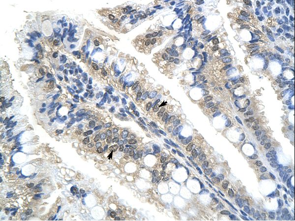 NACC1 / NAC1 Antibody - NACC1 / NAC-1 antibody ARP39772_T100-NP_443108-BTBD14B (BTB (POZ) domain containing 14B) Antibody was used in IHC to stain formalin-fixed, paraffin-embedded human intestine.  This image was taken for the unconjugated form of this product. Other forms have not been tested.