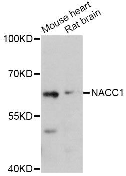 NACC1 / NAC1 Antibody - Western blot analysis of extracts of various cell lines, using NACC1 Antibody at 1:3000 dilution. The secondary antibody used was an HRP Goat Anti-Rabbit IgG (H+L) at 1:10000 dilution. Lysates were loaded 25ug per lane and 3% nonfat dry milk in TBST was used for blocking. An ECL Kit was used for detection and the exposure time was 90s.