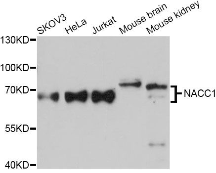 NACC1 / NAC1 Antibody - Western blot analysis of extracts of various cell lines, using NACC1 Antibody at 1:3000 dilution. The secondary antibody used was an HRP Goat Anti-Rabbit IgG (H+L) at 1:10000 dilution. Lysates were loaded 25ug per lane and 3% nonfat dry milk in TBST was used for blocking. An ECL Kit was used for detection and the exposure time was 10s.