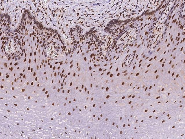 NACC1 / NAC1 Antibody - Immunochemical staining of human NACC1 in human esophagus with rabbit polyclonal antibody at 1:1000 dilution, formalin-fixed paraffin embedded sections.