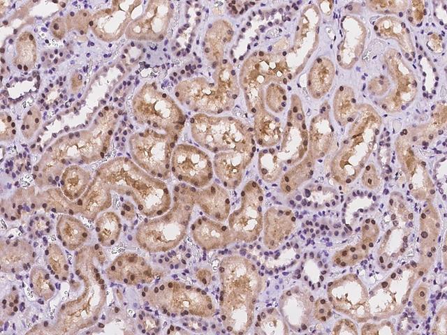 NACC1 / NAC1 Antibody - Immunochemical staining of human NACC1 in human kidney with rabbit polyclonal antibody at 1:1000 dilution, formalin-fixed paraffin embedded sections.