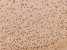 NACC1 / NAC1 Antibody - Immunochemical staining of mouse NACC1 in mouse brain with rabbit polyclonal antibody at 1:1000 dilution, formalin-fixed paraffin embedded sections.