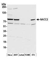 NACC2 / BTBD14A Antibody - Detection of human and mouse NACC2 by western blot. Samples: Whole cell lysate (50 µg) from HeLa, HEK293T, Jurkat, mouse TCMK-1, and mouse NIH 3T3 cells prepared using NETN lysis buffer. Antibody: Affinity purified rabbit anti-NACC2 antibody used for WB at 0.4 µg/ml. Detection: Chemiluminescence with an exposure time of 30 seconds.
