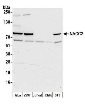NACC2 / BTBD14A Antibody - Detection of human and mouse NACC2 by western blot. Samples: Whole cell lysate (50 µg) from HeLa, HEK293T, Jurkat, mouse TCMK-1, and mouse NIH 3T3 cells prepared using NETN lysis buffer. Antibody: Affinity purified rabbit anti-NACC2 antibody used for WB at 0.4 µg/ml. Detection: Chemiluminescence with an exposure time of 30 seconds.