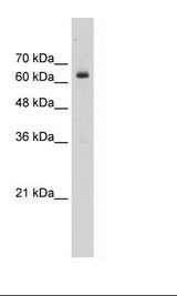 NACC2 / BTBD14A Antibody - Jurkat Cell Lysate.  This image was taken for the unconjugated form of this product. Other forms have not been tested.