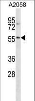 NACC2 / BTBD14A Antibody - NACC2 Antibody western blot of A2058 cell line lysates (35 ug/lane). The NACC2 antibody detected the NACC2 protein (arrow).