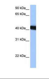 NACC2 / BTBD14A Antibody - HepG2 cell lysate. Antibody concentration: 0.5 ug/ml. Gel concentration: 12%.  This image was taken for the unconjugated form of this product. Other forms have not been tested.