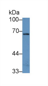 NADK / NAD Kinase Antibody - Western Blot; Sample: Human 293T cell lysate; Primary Ab: 1µg/ml Rabbit Anti-Human NADK Antibody Second Ab: 0.2µg/mL HRP-Linked Caprine Anti-Rabbit IgG Polyclonal Antibody