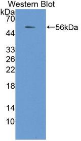 NADK / NAD Kinase Antibody - Western blot of NADK / NAD Kinase antibody.