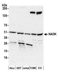 NADK / NAD Kinase Antibody - Detection of human and mouse NADK by western blot. Samples: Whole cell lysate (50 µg) from HeLa, HEK293T, Jurkat, mouse TCMK-1, and mouse NIH 3T3 cells prepared using NETN lysis buffer. Antibody: Affinity purified rabbit anti-NADK antibody used for WB at 1 µg/ml. Detection: Chemiluminescence with an exposure time of 3 minutes.