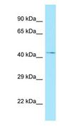 NADK / NAD Kinase Antibody - NADK / NAD Kinase antibody Western Blot of Fetal Kidney.  This image was taken for the unconjugated form of this product. Other forms have not been tested.