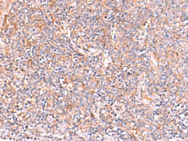 NADK / NAD Kinase Antibody - Immunohistochemistry of paraffin-embedded Human tonsil tissue  using NADK Polyclonal Antibody at dilution of 1:95(×200)