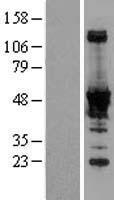 NADK / NAD Kinase Protein - Western validation with an anti-DDK antibody * L: Control HEK293 lysate R: Over-expression lysate