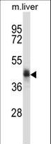 NADK2 / C5orf33 Antibody - C5orf33 Antibody western blot of mouse liver tissue lysates (35 ug/lane). The C5orf33 antibody detected the C5orf33 protein (arrow).