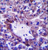 NADK2 / C5orf33 Antibody - C5orf33 Antibody immunohistochemistry of formalin-fixed and paraffin-embedded human liver tissue followed by peroxidase-conjugated secondary antibody and DAB staining.