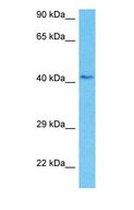NADK2 / C5orf33 Antibody - Western blot of NADK2 Antibody with human Thymus Tumor lysate.  This image was taken for the unconjugated form of this product. Other forms have not been tested.