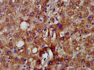 NADK2 / C5orf33 Antibody - Immunohistochemistry image at a dilution of 1:500 and staining in paraffin-embedded human liver tissue performed on a Leica BondTM system. After dewaxing and hydration, antigen retrieval was mediated by high pressure in a citrate buffer (pH 6.0) . Section was blocked with 10% normal goat serum 30min at RT. Then primary antibody (1% BSA) was incubated at 4 °C overnight. The primary is detected by a biotinylated secondary antibody and visualized using an HRP conjugated SP system.