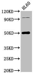 NADK2 / C5orf33 Antibody - Positive Western Blot detected in HL60 whole cell lysate. All lanes: NADK2 antibody at 4 µg/ml Secondary Goat polyclonal to rabbit IgG at 1/50000 dilution. Predicted band size: 50, 46, 32 KDa. Observed band size: 50 KDa