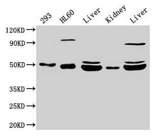NADK2 / C5orf33 Antibody - Western Blot Positive WB detected in: HL60 whole cell lysate All lanes: NADK2 antibody at 4µg/ml Secondary Goat polyclonal to rabbit IgG at 1/50000 dilution Predicted band size: 50, 46, 32 kDa Observed band size: 50 kDa
