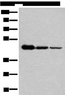 NADK2 / C5orf33 Antibody - Western blot analysis of HEPG2 Hela and A549 cell lysates  using NADK2 Polyclonal Antibody at dilution of 1:600