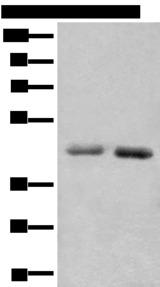 NADK2 / C5orf33 Antibody - Western blot analysis of A549 and Hela cell lysates  using NADK2 Polyclonal Antibody at dilution of 1:1000