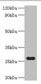 NAD(P)H-flavin reductase Antibody - Western blot All Lanes:NAD(P)H-flavin reductase antibody at 2ug/ml+DH5&alpha; whole cell lysate Secondary Goat polyclonal to rabbit at 1/10000 dilution Predicted band size: 26kDa Observed band size: 26kDa