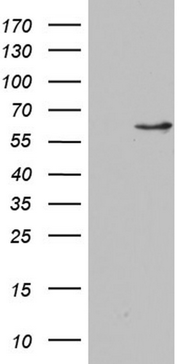 NAE1 / APPBP1 Antibody - HEK293T cells were transfected with the pCMV6-ENTRY control. (Left lane) or pCMV6-ENTRY NAE1. (Right lane) cDNA for 48 hrs and lysed. Equivalent amounts of cell lysates. (5 ug per lane) were separated by SDS-PAGE and immunoblotted with anti-NAE1.