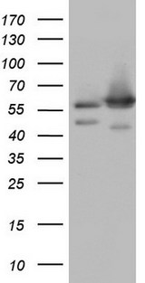NAE1 / APPBP1 Antibody - HEK293T cells were transfected with the pCMV6-ENTRY control. (Left lane) or pCMV6-ENTRY NAE1. (Right lane) cDNA for 48 hrs and lysed. Equivalent amounts of cell lysates. (5 ug per lane) were separated by SDS-PAGE and immunoblotted with anti-NAE1.