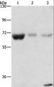 NAE1 / APPBP1 Antibody - Western blot analysis of Human fetal muscle, kidney and liver tissue, using NAE1 Polyclonal Antibody at dilution of 1:500.