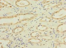 NAE1 / APPBP1 Antibody - Immunohistochemistry of paraffin-embedded human pancreatic tissue at dilution 1:100