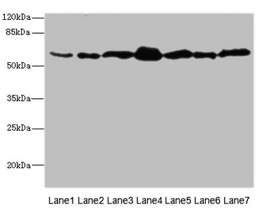 NAE1 / APPBP1 Antibody - Western blot All Lanes: NAE1 antibody at 1.85ug/ml Lane 1: Mouse liver tissue Lane 2: Mouse kidney tissue Lane 3: Mouse skeletal muscle tissue Lane 4: 293T whole cell lysate Lane 5: A431 whole cell lysate Lane 6: K562 whole cell lysate Lane 7: Hela whole cell lysate Secondary Goat polyclonal to rabbit IgG at 1/10000 dilution Predicted band size: 61,60,51 kDa Observed band size: 60 kDa