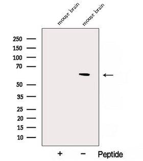 NAE1 / APPBP1 Antibody - Western blot analysis of extracts of HepG2 cells using APPBP1 antibody. The lane on the left was treated with blocking peptide.