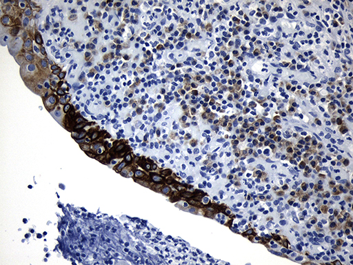 NAF-1 / CISD2 Antibody - Immunohistochemical staining of paraffin-embedded Human lymph node tissue within the normal limits using anti-CISD2 mouse monoclonal antibody. (Heat-induced epitope retrieval by 1mM EDTA in 10mM Tris buffer. (pH8.5) at 120°C for 3 min. (1:500)