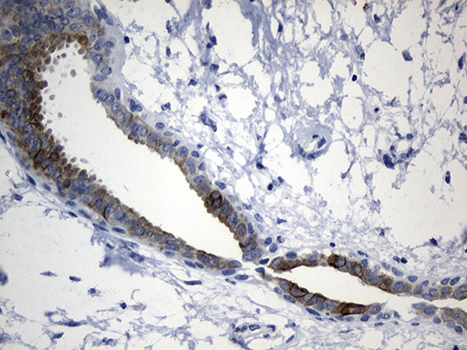 NAF-1 / CISD2 Antibody - Immunohistochemical staining of paraffin-embedded Human breast tissue within the normal limits using anti-CISD2 mouse monoclonal antibody. (Heat-induced epitope retrieval by 1mM EDTA in 10mM Tris buffer. (pH8.5) at 120°C for 3 min. (1:500)