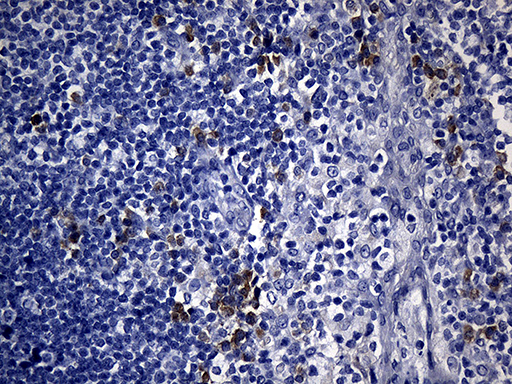 NAF-1 / CISD2 Antibody - Immunohistochemical staining of paraffin-embedded Human tonsil within the normal limits using anti-CISD2 mouse monoclonal antibody. (Heat-induced epitope retrieval by 1mM EDTA in 10mM Tris buffer. (pH8.5) at 120°C for 3 min. (1:500)