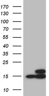 NAF-1 / CISD2 Antibody - HEK293T cells were transfected with the pCMV6-ENTRY control. (Left lane) or pCMV6-ENTRY CISD2. (Right lane) cDNA for 48 hrs and lysed. Equivalent amounts of cell lysates. (5 ug per lane) were separated by SDS-PAGE and immunoblotted with anti-CISD2. (1:2000)