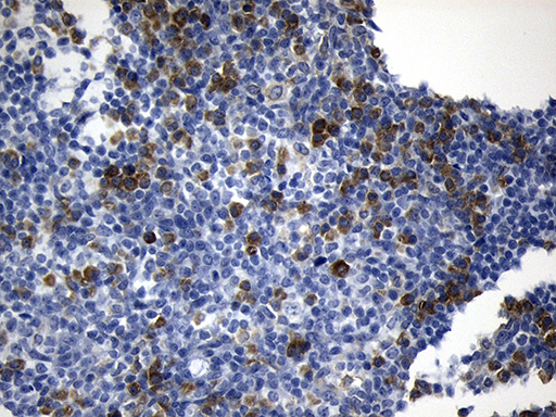 NAF-1 / CISD2 Antibody - Immunohistochemical staining of paraffin-embedded Human tonsil within the normal limits using anti-CISD2 mouse monoclonal antibody. (Heat-induced epitope retrieval by 1mM EDTA in 10mM Tris buffer. (pH8.5) at 120°C for 3 min. (1:150)