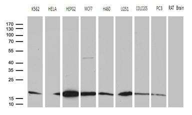 NAF-1 / CISD2 Antibody - Western blot analysis of extracts. (35ug) from 8 different cell lines and rat brain tissue lysate by using anti-CISD2 monoclonal antibody. (1:500)