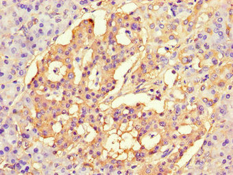 NAF-1 / CISD2 Antibody - Immunohistochemistry of paraffin-embedded human pancreatic tissue using CISD2 Antibody at dilution of 1:100