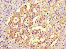 NAF-1 / CISD2 Antibody - Immunohistochemistry of paraffin-embedded human pancreatic tissue using CISD2 Antibody at dilution of 1:100