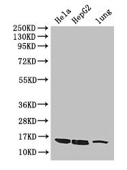 NAF-1 / CISD2 Antibody - Western Blot Positive WB detected in: Hela whole cell lysate, HepG2 whole cell lysate, Mouse spleen tissue, Mouse lung tissue, Mouse kidney tissue, Mouse brain tissue All lanes: CISD2 antibody at 3µg/ml Secondary Goat polyclonal to rabbit IgG at 1/50000 dilution Predicted band size: 16 kDa Observed band size: 16 kDa