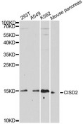 NAF-1 / CISD2 Antibody - Western blot analysis of extracts of various cell lines, using CISD2 antibody at 1:1000 dilution. The secondary antibody used was an HRP Goat Anti-Rabbit IgG (H+L) at 1:10000 dilution. Lysates were loaded 25ug per lane and 3% nonfat dry milk in TBST was used for blocking. An ECL Kit was used for detection and the exposure time was 90s.