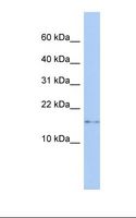 NAF-1 / CISD2 Antibody - Transfected 293T cell lysate. Antibody concentration: 1.0 ug/ml. Gel concentration: 10-20%.  This image was taken for the unconjugated form of this product. Other forms have not been tested.