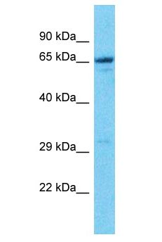 NAG20 / UBAP1 Antibody - NAG20 / UBAP1 antibody Western Blot of Jurkat. Antibody dilution: 1 ug/ml.  This image was taken for the unconjugated form of this product. Other forms have not been tested.