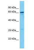 NAG20 / UBAP1 Antibody - NAG20 / UBAP1 antibody Western Blot of Jurkat. Antibody dilution: 1 ug/ml.  This image was taken for the unconjugated form of this product. Other forms have not been tested.