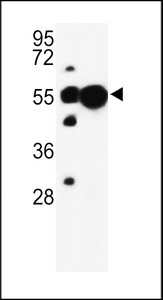 NAG20 / UBAP1 Antibody - Western blot of UBAP1 Antibody in mouse liver, cerebellum tissue lysates (35 ug/lane). UBAP1 (arrow) was detected using the purified antibody.