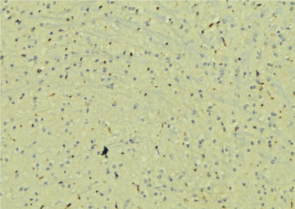 NAG20 / UBAP1 Antibody - 1:100 staining mouse brain tissue by IHC-P. The sample was formaldehyde fixed and a heat mediated antigen retrieval step in citrate buffer was performed. The sample was then blocked and incubated with the antibody for 1.5 hours at 22°C. An HRP conjugated goat anti-rabbit antibody was used as the secondary.