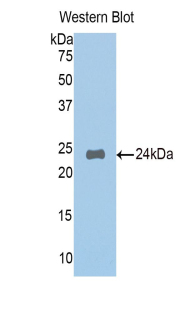 NAGA Antibody - Western blot of recombinant NAGA.  This image was taken for the unconjugated form of this product. Other forms have not been tested.